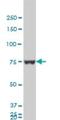 Heterogeneous Nuclear Ribonucleoprotein M antibody, H00004670-M03, Novus Biologicals, Western Blot image 