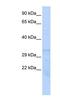 Proteasome Subunit Beta 1 antibody, NBP1-54583, Novus Biologicals, Western Blot image 