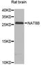 Probable N-acetyltransferase 8B antibody, A12810, Boster Biological Technology, Western Blot image 