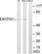 Ectonucleoside Triphosphate Diphosphohydrolase 1 antibody, LS-C119945, Lifespan Biosciences, Western Blot image 