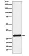 Serine Protease 2 antibody, M05763, Boster Biological Technology, Western Blot image 