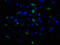 Tumor Susceptibility 101 antibody, CSB-MA860355A0m, Cusabio, Immunofluorescence image 