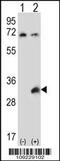 Testis Specific Serine Kinase 6 antibody, 56-443, ProSci, Western Blot image 