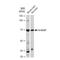 WASP Like Actin Nucleation Promoting Factor antibody, GTX03240, GeneTex, Western Blot image 