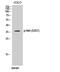 ETS Transcription Factor ELK3 antibody, A06026S357, Boster Biological Technology, Western Blot image 