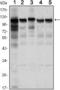 Hexokinase 1 antibody, MA5-15675, Invitrogen Antibodies, Western Blot image 