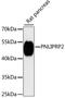 Pancreatic Lipase Related Protein 2 (Gene/Pseudogene) antibody, LS-C747964, Lifespan Biosciences, Western Blot image 
