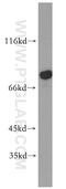 Adenosine Monophosphate Deaminase 1 antibody, 19780-1-AP, Proteintech Group, Western Blot image 