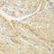 Translocase Of Outer Mitochondrial Membrane 20 antibody, 22-476, ProSci, Immunohistochemistry paraffin image 