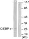 CCAAT Enhancer Binding Protein Epsilon antibody, PA5-38691, Invitrogen Antibodies, Western Blot image 