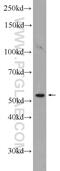 High Mobility Group Nucleosome Binding Domain 5 antibody, 23955-1-AP, Proteintech Group, Western Blot image 