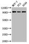 Adenosine Monophosphate Deaminase 1 antibody, LS-C672761, Lifespan Biosciences, Western Blot image 