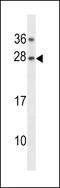 GAR1 Ribonucleoprotein antibody, 60-507, ProSci, Western Blot image 