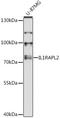 Interleukin 1 Receptor Accessory Protein Like 2 antibody, LS-C748145, Lifespan Biosciences, Western Blot image 