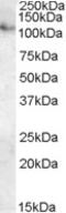 Protein Phosphatase 2 Regulatory Subunit B''Alpha antibody, 46-701, ProSci, Enzyme Linked Immunosorbent Assay image 