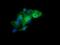 Leucine Zipper And CTNNBIP1 Domain Containing antibody, NBP2-45704, Novus Biologicals, Immunofluorescence image 