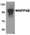 Inositol Polyphosphate-4-Phosphatase Type II B antibody, A06336, Boster Biological Technology, Western Blot image 