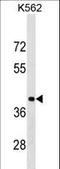 Poly(RC) Binding Protein 1 antibody, LS-C158543, Lifespan Biosciences, Western Blot image 