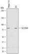 Solute Carrier Family 39 Member 4 antibody, PA5-47915, Invitrogen Antibodies, Western Blot image 