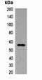 Cadherin 13 antibody, orb323032, Biorbyt, Western Blot image 
