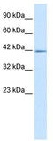 IKAROS Family Zinc Finger 2 antibody, TA329380, Origene, Western Blot image 