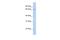 DnaJ Heat Shock Protein Family (Hsp40) Member C1 antibody, A08726, Boster Biological Technology, Western Blot image 