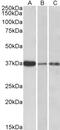 Neutrophil Cytosolic Factor 4 antibody, 45-937, ProSci, Western Blot image 