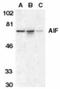 Apoptosis Inducing Factor Mitochondria Associated 1 antibody, NBP1-52446, Novus Biologicals, Western Blot image 