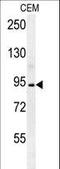 Brevican antibody, LS-C156755, Lifespan Biosciences, Western Blot image 