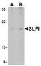 Secretory Leukocyte Peptidase Inhibitor antibody, AP05707PU-N, Origene, Western Blot image 