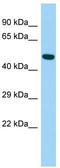 Arrestin Domain Containing 4 antibody, TA331309, Origene, Western Blot image 