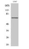 Spleen Associated Tyrosine Kinase antibody, STJ90775, St John