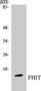 Fragile Histidine Triad Diadenosine Triphosphatase antibody, EKC1215, Boster Biological Technology, Western Blot image 