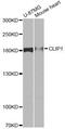 CAP-Gly Domain Containing Linker Protein 1 antibody, A12498, ABclonal Technology, Western Blot image 