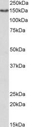 C-Type Lectin Domain Family 12 Member A antibody, 43-576, ProSci, Enzyme Linked Immunosorbent Assay image 