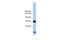 Phosphatidylinositol Glycan Anchor Biosynthesis Class O antibody, 26-474, ProSci, Enzyme Linked Immunosorbent Assay image 