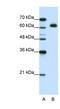 DIS3 Like 3'-5' Exoribonuclease 2 antibody, NBP1-80479, Novus Biologicals, Western Blot image 
