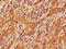 Ceramide kinase antibody, CSB-PA005256LA01HU, Cusabio, Immunohistochemistry paraffin image 