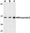 Presenilin 1 antibody, orb74832, Biorbyt, Western Blot image 
