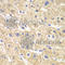 Short-chain specific acyl-CoA dehydrogenase, mitochondrial antibody, A7230, ABclonal Technology, Immunohistochemistry paraffin image 