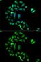 Chloride Intracellular Channel 1 antibody, GTX65866, GeneTex, Immunocytochemistry image 