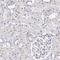 Translocon-associated protein subunit delta antibody, HPA045209, Atlas Antibodies, Immunohistochemistry paraffin image 