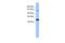 Mitogen-Activated Protein Kinase Kinase Kinase 1 antibody, PA5-43209, Invitrogen Antibodies, Western Blot image 