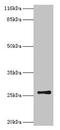 Thymidine Kinase 1 antibody, CSB-PA023577HA01HU, Cusabio, Western Blot image 