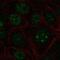 Zinc Finger And BTB Domain Containing 14 antibody, PA5-67128, Invitrogen Antibodies, Immunofluorescence image 