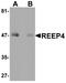 Receptor Accessory Protein 4 antibody, A12670, Boster Biological Technology, Western Blot image 