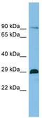 Chromatin Target Of PRMT1 antibody, TA333802, Origene, Western Blot image 