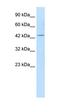 Potassium Voltage-Gated Channel Subfamily Q Member 1 antibody, orb329835, Biorbyt, Western Blot image 