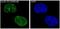 Cyclin D1 antibody, M00149-1, Boster Biological Technology, Immunofluorescence image 