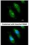 Survival Of Motor Neuron 2, Centromeric antibody, PA5-27309, Invitrogen Antibodies, Immunofluorescence image 